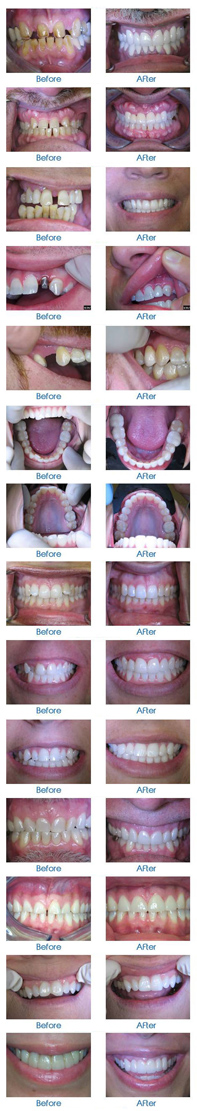 Smile Gallery before and after sidebar copy